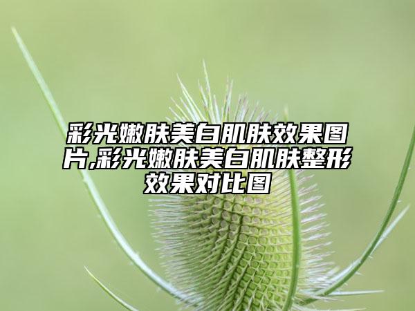 彩光嫩肤美白肌肤效果图片,彩光嫩肤美白肌肤整形效果对比图