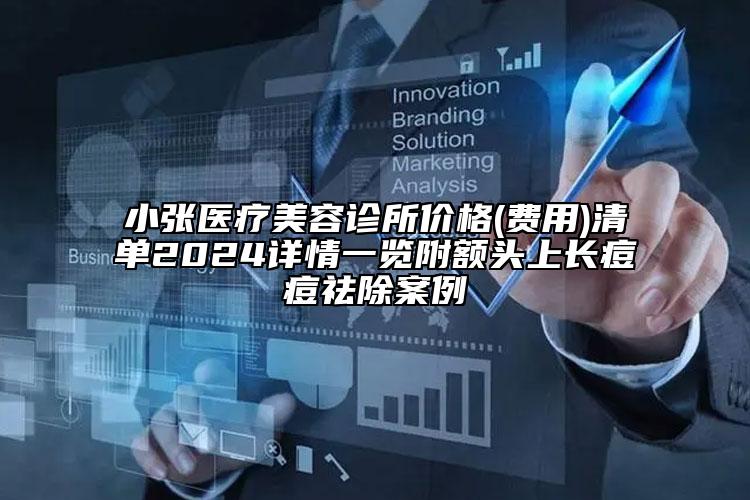 小张医疗美容诊所价格(费用)清单2024详情一览附额头上长痘痘祛除案例