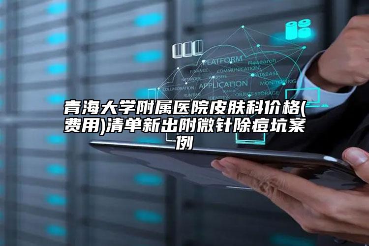 青海大学附属医院皮肤科价格(费用)清单新出附微针除痘坑案例