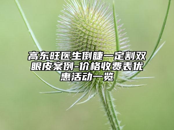 高东旺医生倒睫一定割双眼皮案例-价格收费表优惠活动一览