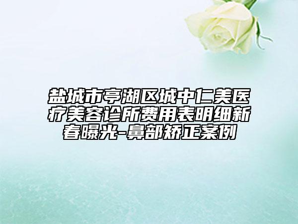 盐城市亭湖区城中仁美医疗美容诊所费用表明细新春曝光-鼻部矫正案例