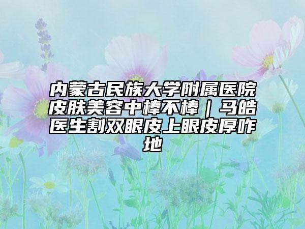 内蒙古民族大学附属医院皮肤美容中棒不棒｜马皓医生割双眼皮上眼皮厚咋地