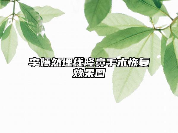 李嫣然埋线隆鼻手术恢复效果图