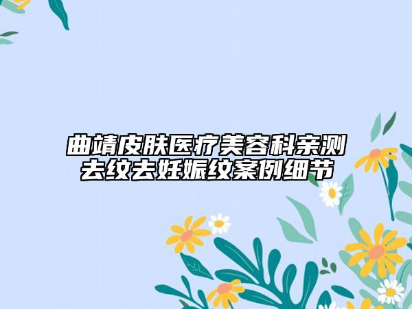 曲靖皮肤医疗美容科亲测去纹去妊娠纹案例细节