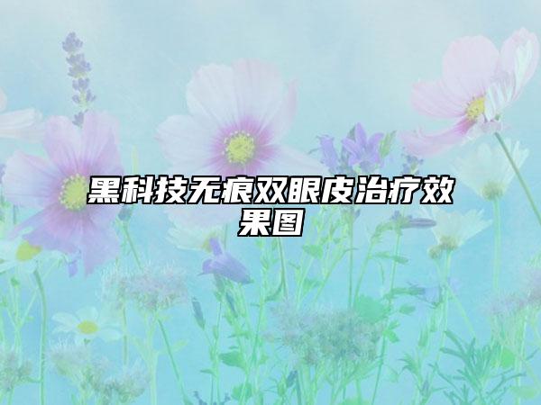 黑科技无痕双眼皮治疗效果图