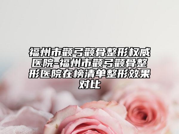 福州市颧弓颧骨整形权威医院-福州市颧弓颧骨整形医院在榜清单整形效果对比