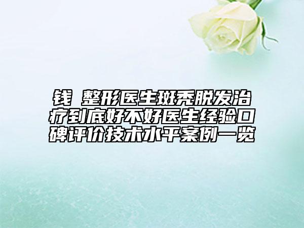 钱昇整形医生斑秃脱发治疗到底好不好医生经验口碑评价技术水平案例一览